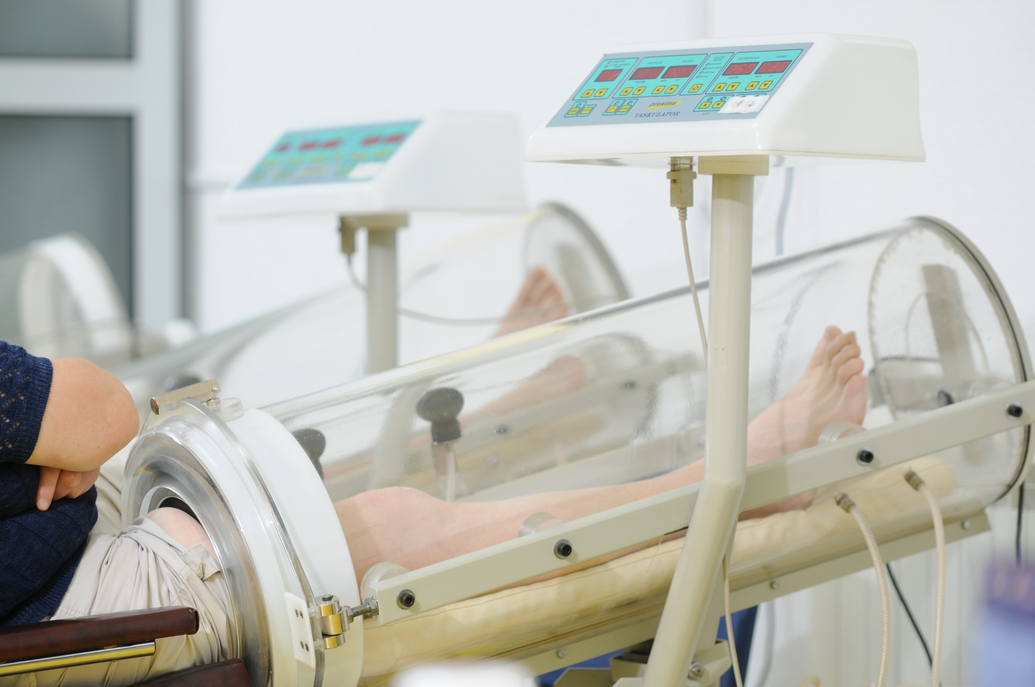 Komplikacije dijabetesa/Dijabetesno stopalo